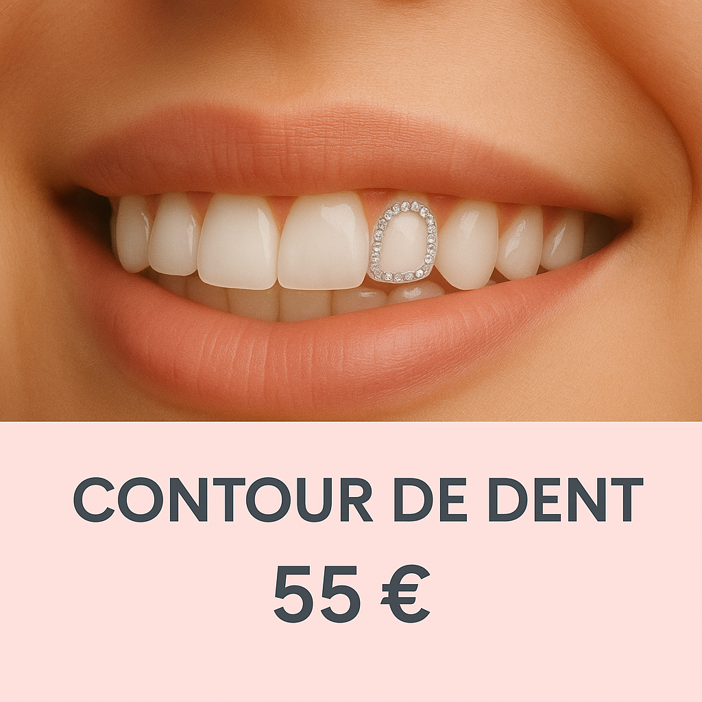 Prestation – Pose de strass dentaires