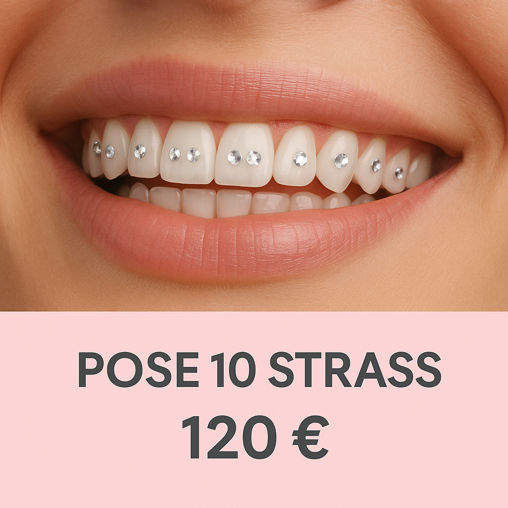 Prestation – Pose de strass dentaires