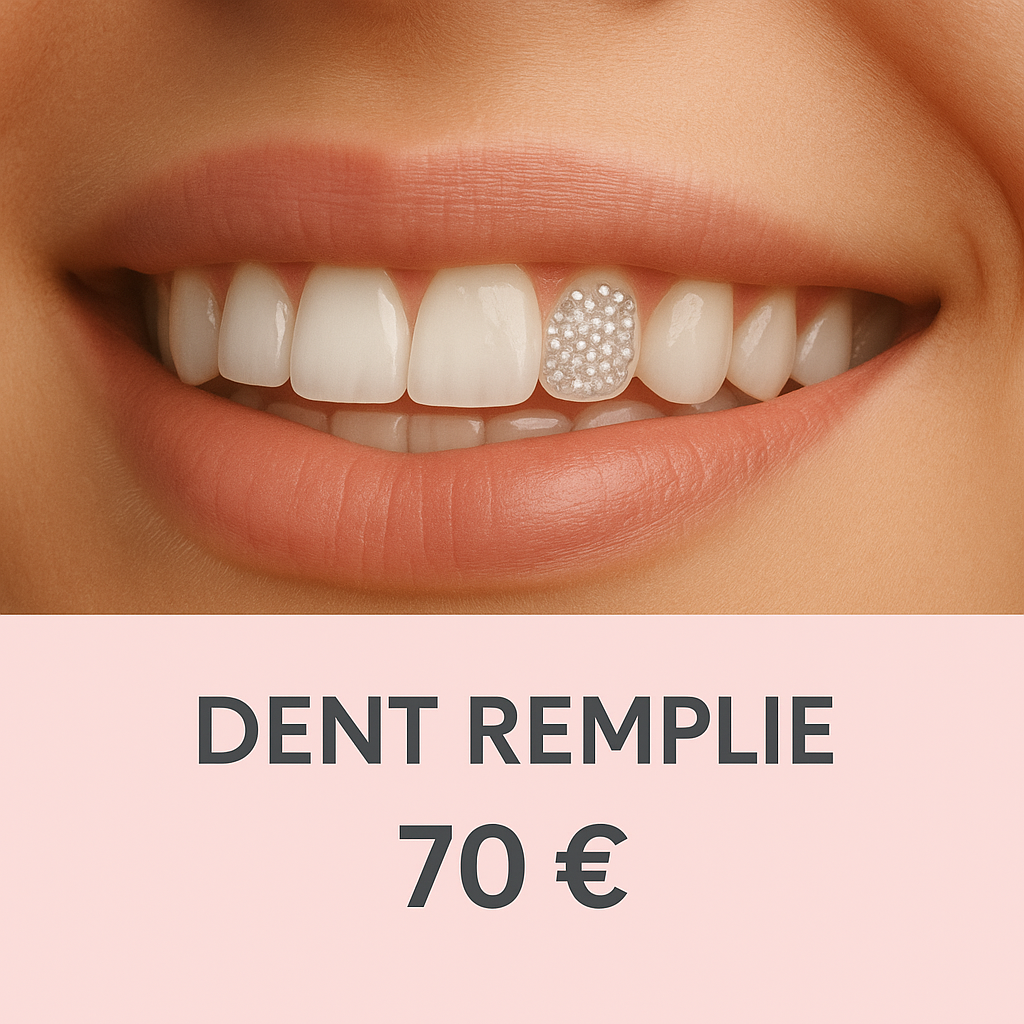 Prestation – Pose de strass dentaires